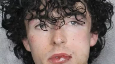 Conor McAneney's booking mugshot showing facial injuries.