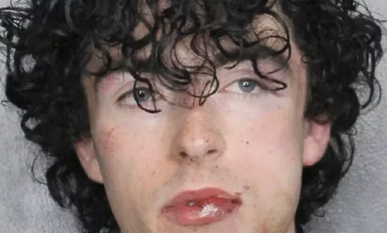 Conor McAneney's booking mugshot showing facial injuries.