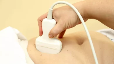 An ultrasound machine in a hospital examination room.