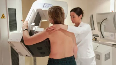 NHS mammogram screening machine in a hospital examination room